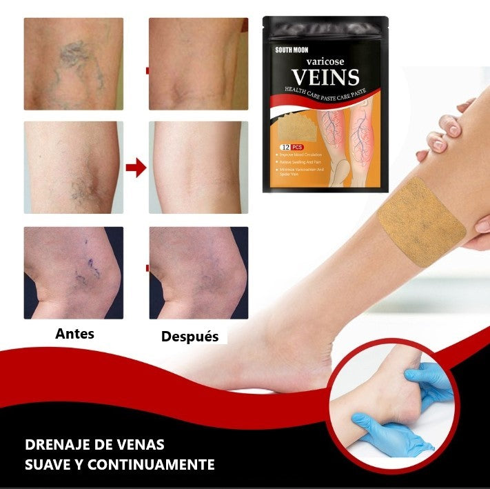 PARCHES PARA VARICES - PACK X 48 PARCHES